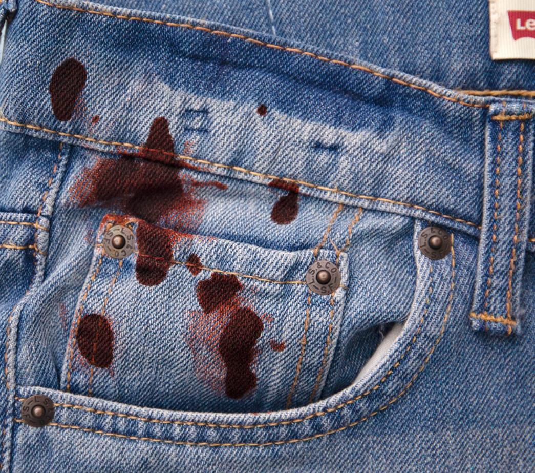 LAY OPINION TESTIMONY ON A BLOODSTAIN IS ADMISSIBLE (Peo. v. Phillips, 1DCA, #A156387, 2022 App. App. Lexis 164, 2/28/22)